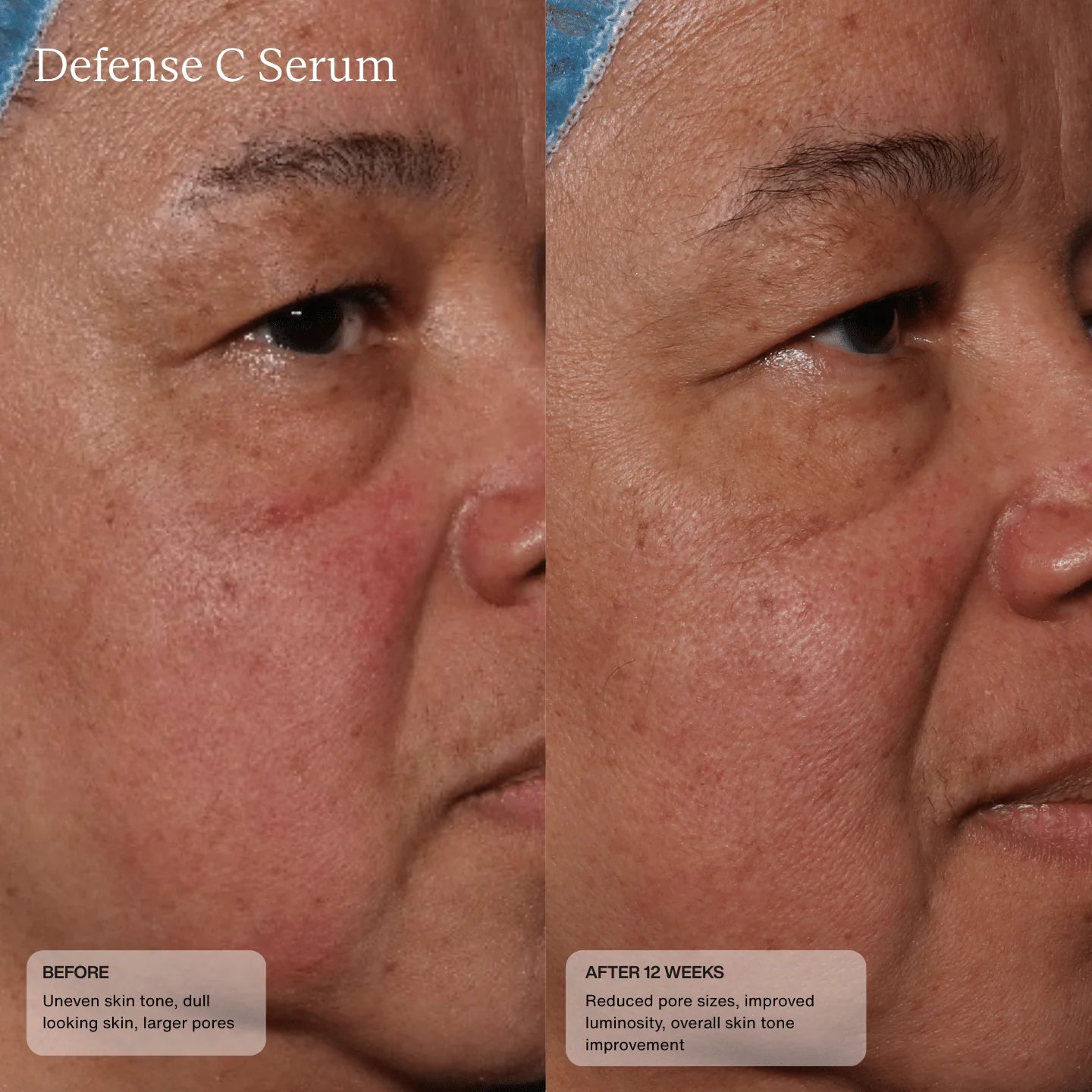 Defense C Serum