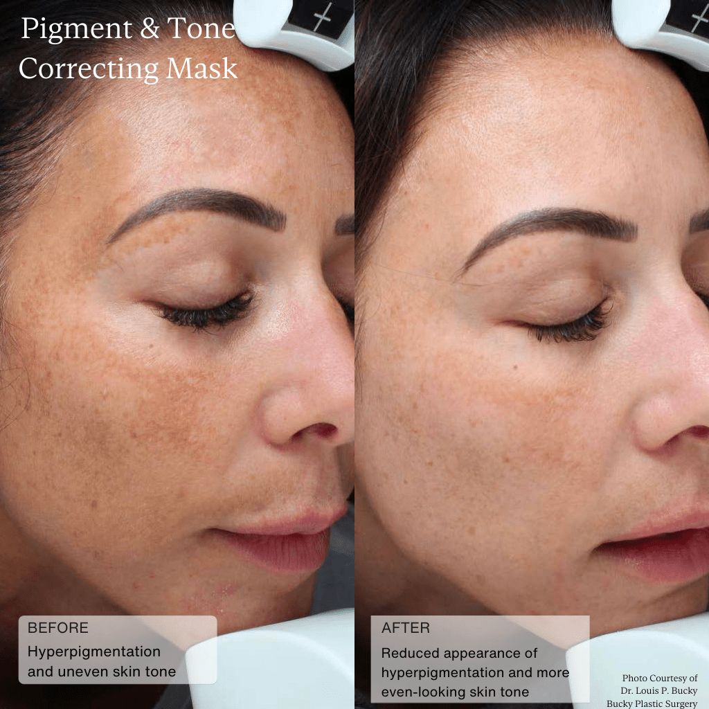 Pigment & Tone Correcting Mask